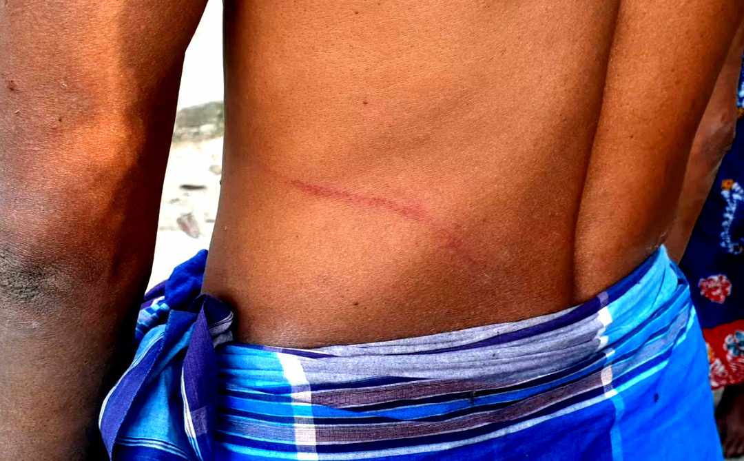 সদরপুরে কিস্তির টাকা না পেয়ে মৎস্যজীবীকে পেটালেন এনজিও কর্মীরা